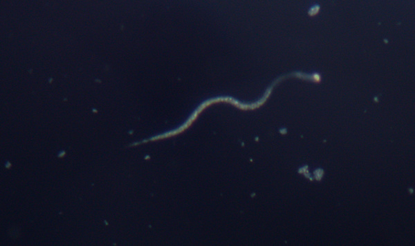 Een wereld vol aaltjes